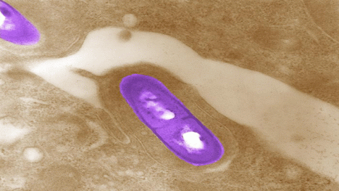 بمكتيريا ليستيريا 